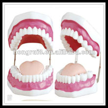 ISO Dental Care Modell (28 Zähne), Zähne Modell HR-403
